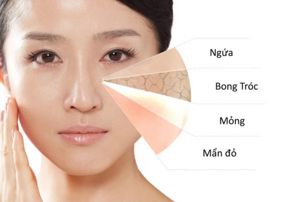 Các vấn đề về da thường gặp phải khi vào mùa hanh khô