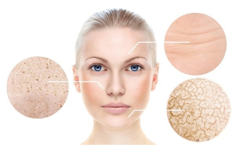 Tìm hiểu da khô lỗ chân lông to là gì?