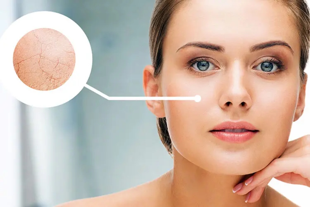 Tại sao cần phải cấp nước cho da khô?