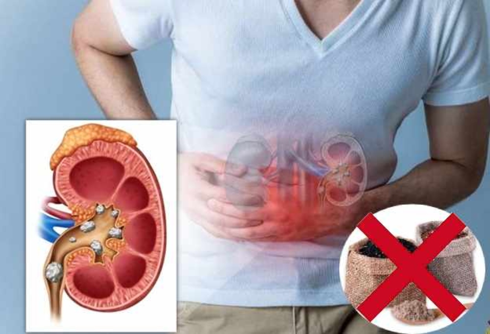 Người bị sỏi thận thì không nên sử dụng bột gạo lứt mè đen