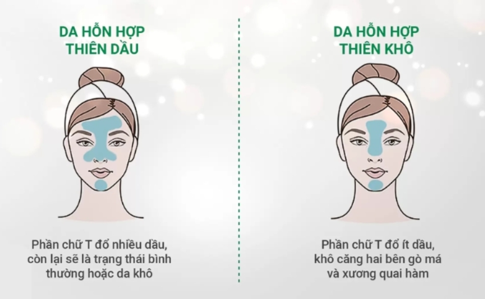 Làn da hỗn hợp là làn da có cả đặc điểm của da dầu và da khô